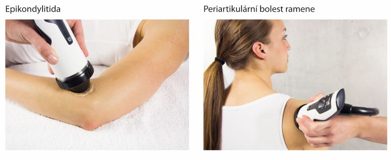 fokusovaná rázová vlna Duolith
